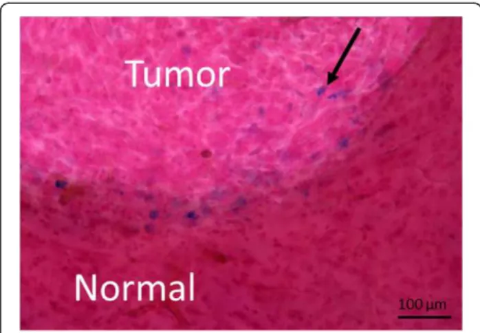 Figure 1 Microscopic images of mouse glioma sections obtained using Prussian Blue staining collected after the last MRI session (24 hours after intravenous injection of the targeted contrast agent)