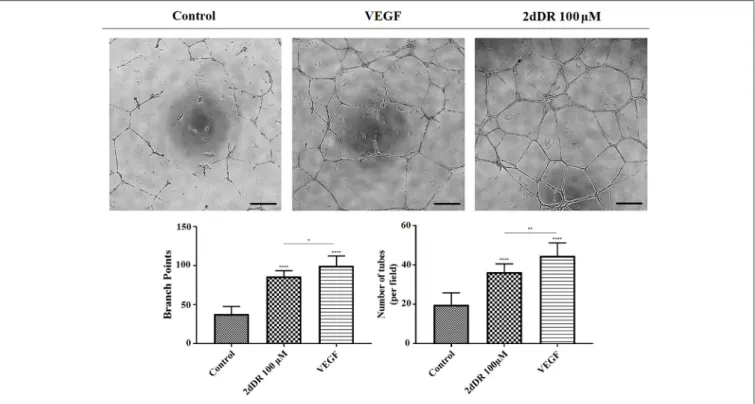 FIGURE 5 | The effect of 100µM 2dDR and VEGF on tube formation was assessed with Matrigel ® tube formation assay