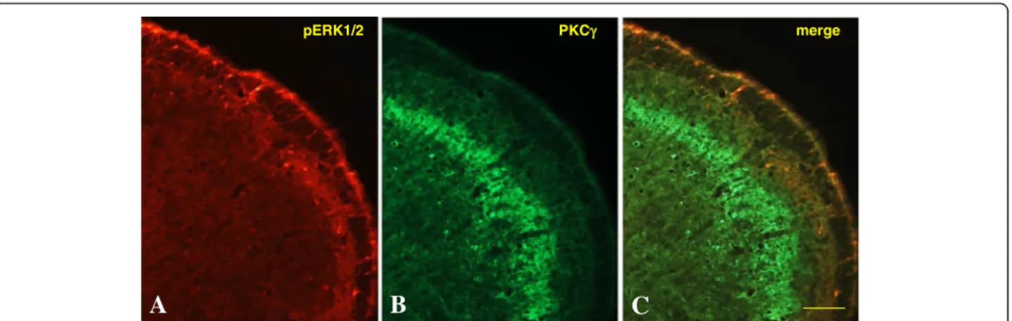 Fig. 5 Double labeling using pERK1/2 (a) and PKC γ (b) antibodies in CCI-IoN + 6-OHDA rats