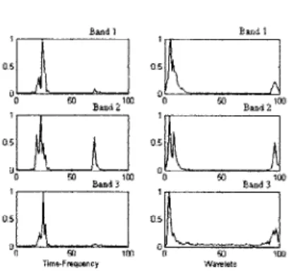 Figure  5-9:  Prototypical  systoles  for  patient  22,  using  filter  bank  and  wavelet  band approaches.