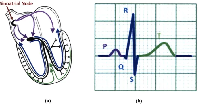Figure  1-2.  Electrophysiology  of the heart. Figure  I-2a depicts the electrical  impulses  travelling through the heart, and Figure  I-2b shows  the corresponding  ECG signal  recorded