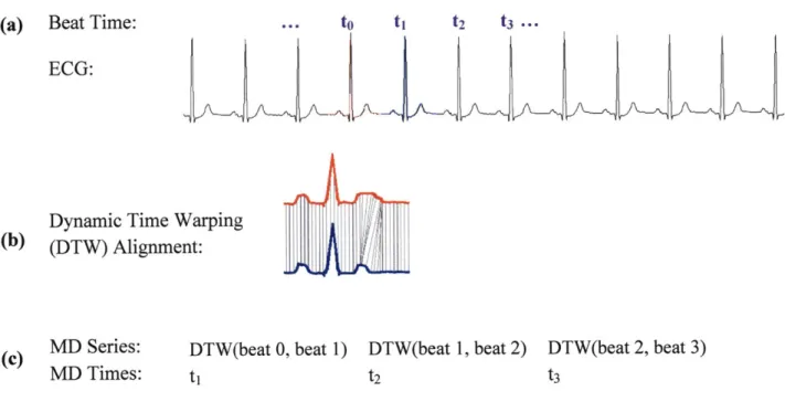 Figure 11-2.  MD  time series.  The  successive  beats of an ECG  (a) are  aligned using  dynamic time warping  (DTW) (b)