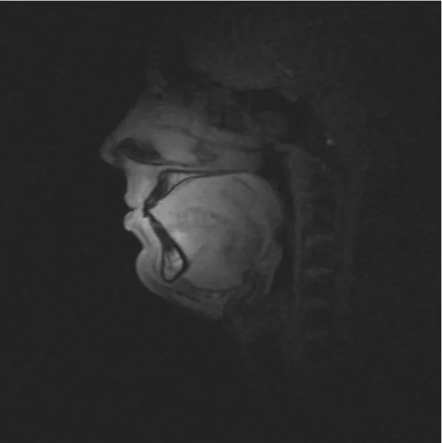 Figure 2.0.1: MRI T 1 weighted image of the tongue