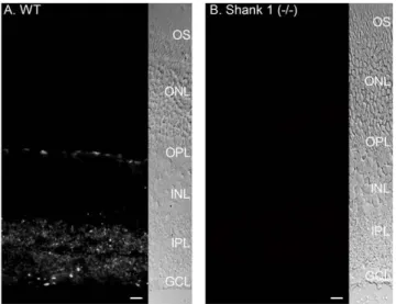 Figure 3. Shank 1A is expressed with PSD-95 labeled photoreceptor terminals in the mouse thy-1.2 YFP 16 line retina