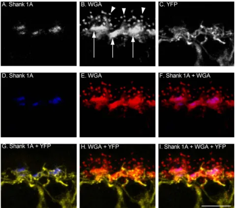 Figure 6. Shank 1A immunoreactivity co-localizes with the lectin WGA at cone photoreceptor terminals