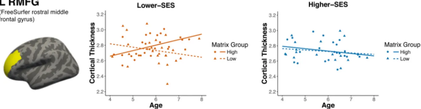 Fig. 4. Three-way interaction between age, maternal education, and matrix reasoning on left rostral middle frontal gyrus (L RMFG) thickness (mm) in the early childhood sample