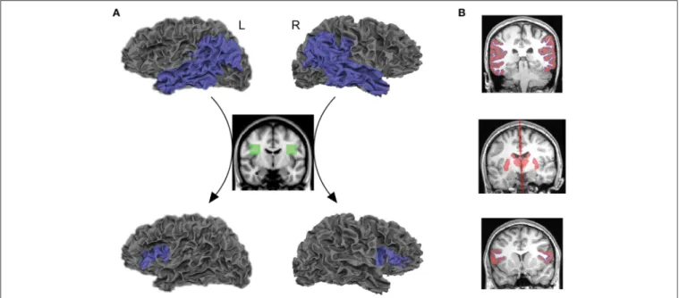 FIGURE 1 | Seed and target regions, as well as inclusion and exclusion masks for tractography and structural connectivity analyses