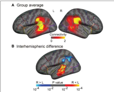 FIGURE 3 | Group analyses of the arcuate fasciculus (AF) projections in the inferior parietal and lateral temporal cortices