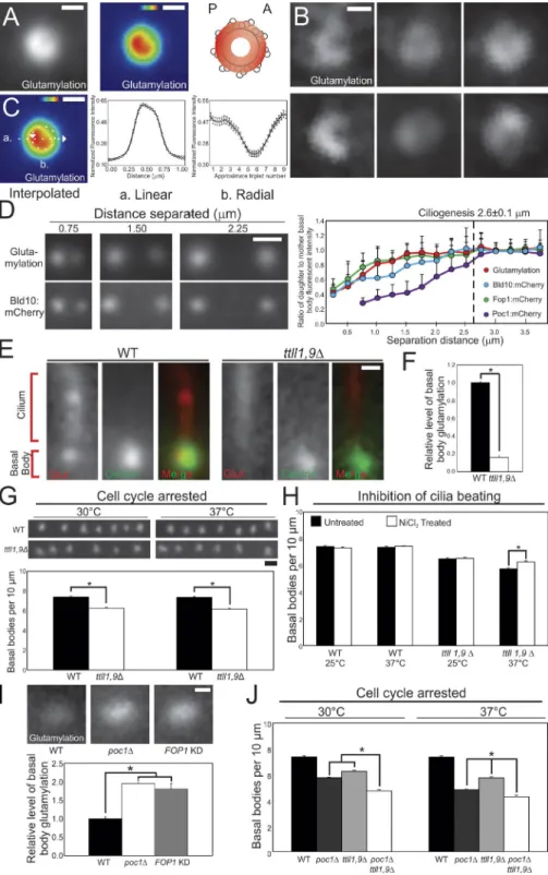 Figure 5. Microtubule glutamylation sta- sta-bilizes BBs differentially from BB stability  proteins