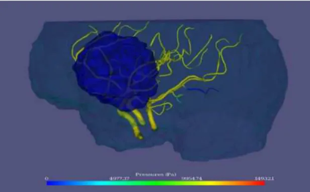 Fig. 3. Typical vascular network extracted from a ToF MRA and used for simulation. Tumor is identified in blue.