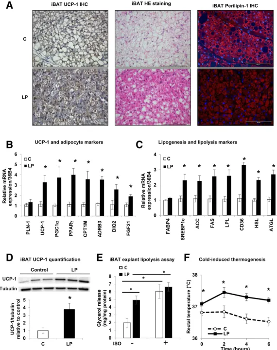 Figure 2 — iBAT is hyperactive in 3-month-old LP progeny. A : Representative IHC of UCP-1 with hematoxylin and eosin (HE) staining of iBAT in C and LP rats ( n = 6) of 3-month-old progenies