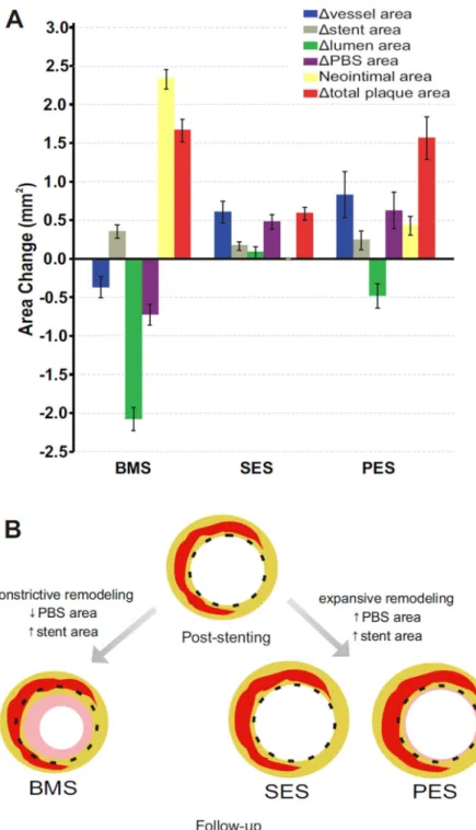 Fig. 1. Vascular responses after bare-metal (BMS), sirolimus-eluting (SES), and paclitaxel- paclitaxel-eluting (PES) stent implantation