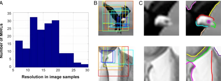 Fig. 3. (A) Distribution of MIRCs ’ resolution (measured in image samples), average 14.92 ± 5.2 samples