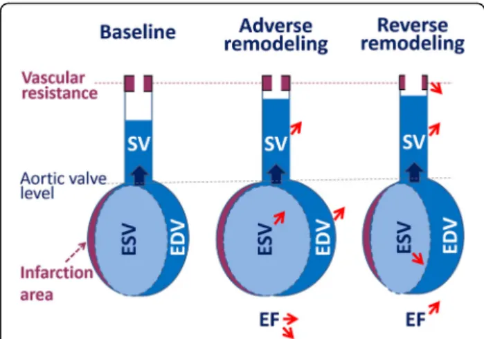 Fig. 3 Schematic representation of the influence of the decrease in systemic vascular resistance in the mechanisms leading to reverse remodeling (where stroke volume (SV) may be improved owing to an increase in ejection fraction (EF) with a decrease in end
