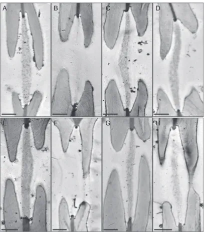 Fig. 4. TEM images of intervessel pit structure of hydrolase-treated branches. All images are from transverse and ultrathin (70 nm) sections prepared from three branches per treatment