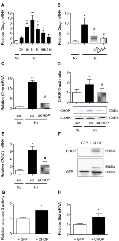 Figure 6.  CHOP is involved in hypoxia-induced alveolar epithelial cells apoptosis. Chop mRNA expression  was evaluated by RT-qPCR in primary rat AECs placed in normoxia (Nx) (21% of O 2 ) or exposed to hypoxia  (Hx) (1.5% of O 2 ) for increasing times (4-