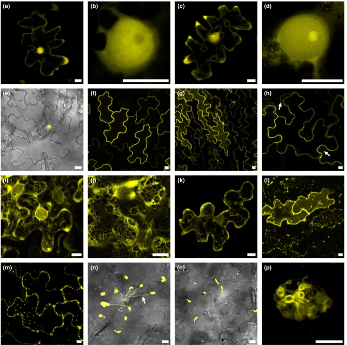 Figure 4. Plasmopara halstedii core RXLR effectors target the nucleus and other organelles of sunflower cells.Confocal images of p35S-YFP-PhRXLR constructs that were transiently expressed in sunflower leaves by agroinfiltration
