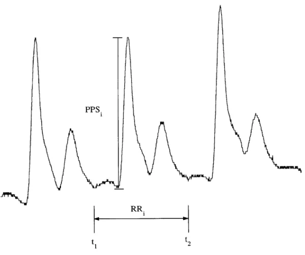 Figure 2-7: Processing  the ABP waveform  using R  wave  locations  as guidelines.