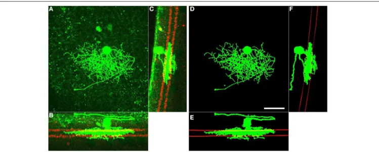 FIGURE 2 | Fully automated enhancement and post-processing of RGC arbors (green), and detection of starburst surfaces (red).