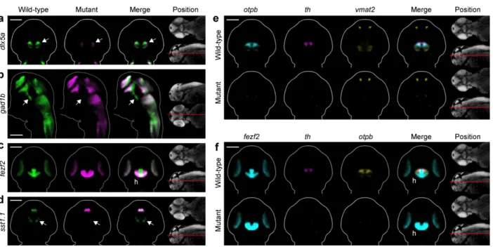 Figure 4: Automated phenotyping uncovers known and novel diencephalic deficits in fezf2 mutants