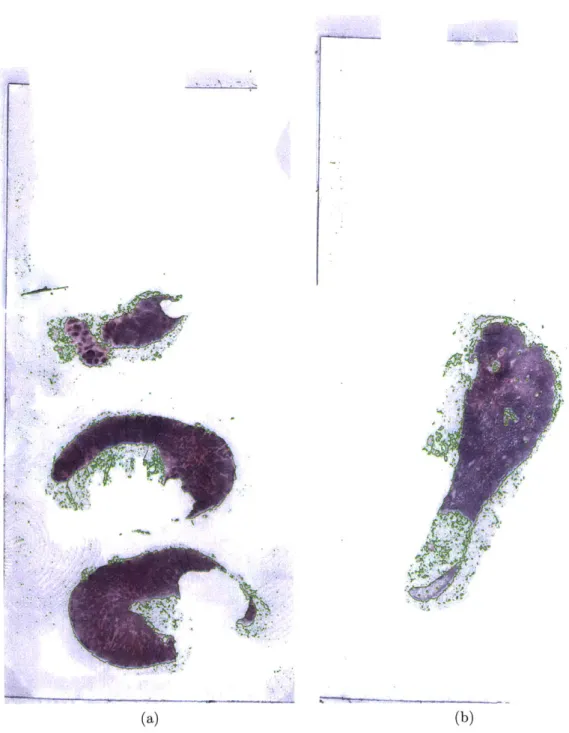 Figure  3-5:  Results  of  background  removal.  The  green  lines  delineate  the  regions ultimately  processed  by  the  subsequent  steps