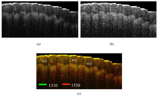 Fig 5. In vivo OFDI images (3mm × 1.2mm) of human finger acquired from our fiber-based simultaneous dual-band SS-OCT system  processed at individual center wavelength of 1310 nm (a) and 1550 nm (b)