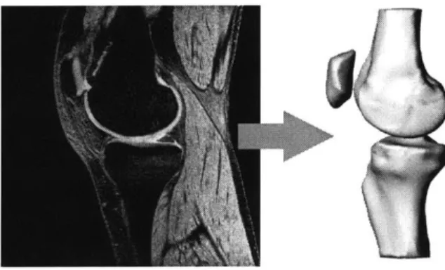 Figure  2-2:  An  example  MRI  slice  on  the  left  used  to  construct  the  3D  surface  model on  the  right.