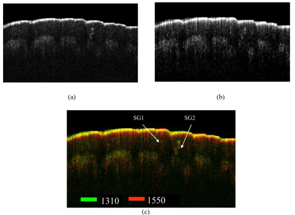 Fig 5. In vivo OCT images (2.5mm × 1.7 mm) of human finger acquired from our fiber-based simultaneous dual-band SS-OCT system  processed at individual center wavelength of 1310 nm (a) and 1550 nm (b)