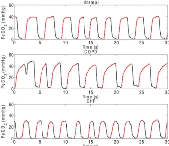 Fig.  1.    Template  exhalation  from  a  COPD  capnogram.  Capnogram  exhalations  (blue)  are  aligned  at  15  mmHg  PeCO 2   and  then  vertically  averaged to construct the capnogram template (red)