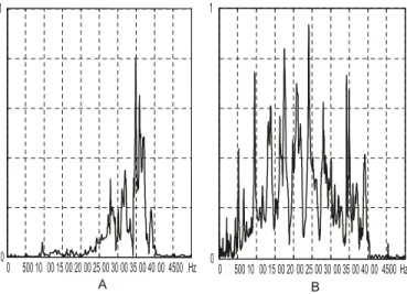 Fig. 2. (A) Frequency response function (FRF) of a transverse gra- gra-dient coil. (B) FRF of the longitudinal gragra-dient coil