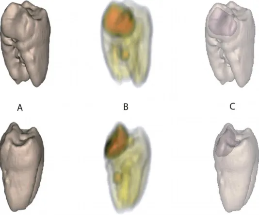 Fig. 5. Maximum intensity projections 17 of the same tooth shown in Fig. 4. The two orientations shown in the top and bottom row of Fig