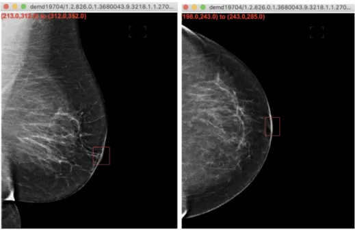 Figure 4-1: Annotation tool created for the purposes of this study for nipple detection.