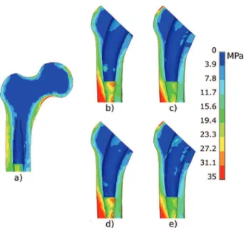 Table 5 presents the percentages of surface sub- sub-jected to micromotions of the proximal implant  sur-faces presented in Fig