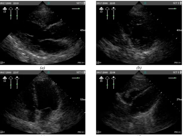 Fig. 2-1.  Good quality typical cardiac ultrasound images.  (a) Parasternal long axis (PLX) view