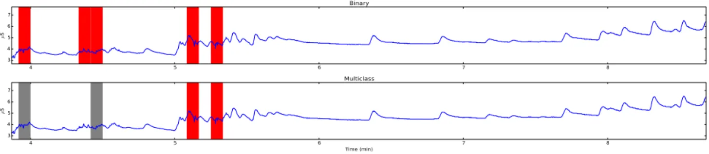 Fig. 3. A subset of a single participant’s data which includes true SCRs and artifacts