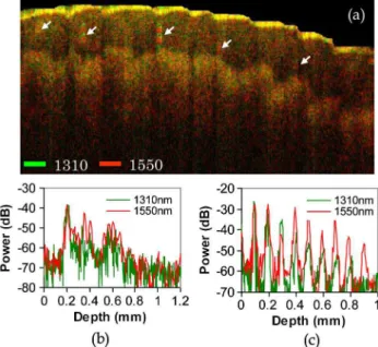 Fig. 4. (Color online) (a) In vivo color-encoded OCT image ( 3 mm × 1 : 2 mm) of a human finger