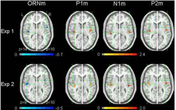 Fig. 1. ER-SAM pseudo-Z value maps (group image results) overlaid on a brain  image conforming to Talairach space