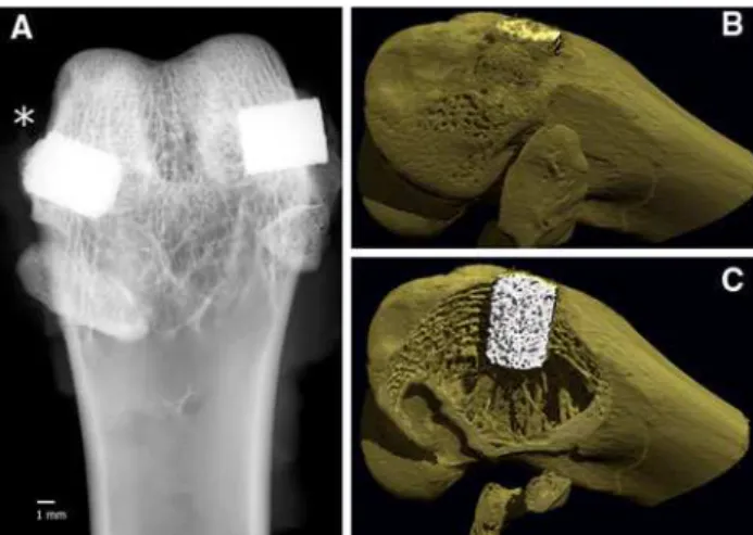 Figure 5 compares BSEM and lCT images of a longitu- longitu-dinal section cut from a retrieved and osseointegrated porous Ti implant
