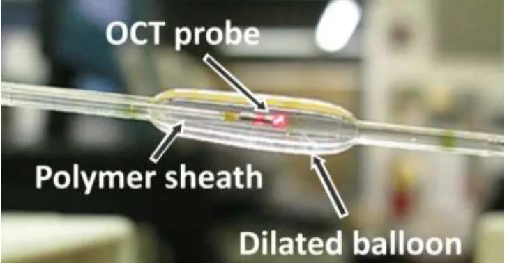 Figure 1. OCT catheter probe inserted in a partially inflated balloon. 