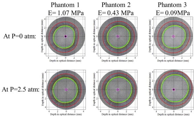 Figure 5 presents the results for the inner and outer phantom diameters resulting from the finite-element simulation along  with those obtained experimentally with IVOCT