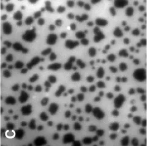 Figure 1 ABC 5 µm