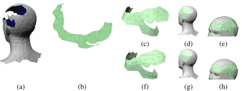 Fig. 7. Head model 2. (a): Hole in the head of a human model. (b): Unfolded mesh. (c)-(e): Final embedded mesh obtained by minimizing E L 