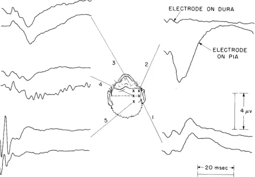 Figure  11  shows  the  responses  recorded  from  the  dural  and  pial  surfaces  of  the brain