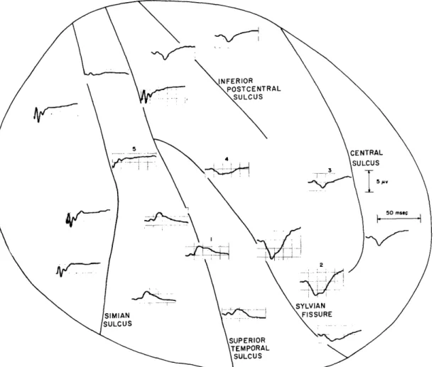 Fig.  12.  Average  responses  obtained  at  various  points  on  the  exposed  pial  surface  of Monkey  S(M-6)