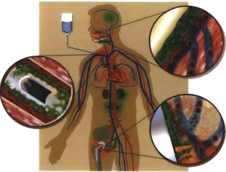 Figure 1.2.  Bioflim  implant infections.  Schematic  depiction  of implants that can  become infected with biofilms  and  seed new infections  in the body