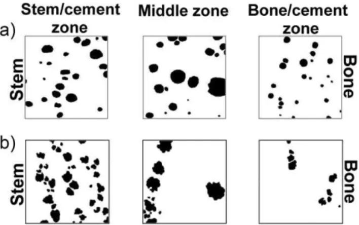 FIGURE 7. Porosity distribution across cement mantle for the three zones of analysis T stem ¼ T cement ¼ 24  C: (a) hand mixed Simplex P (b) hand mixed Palacos R.