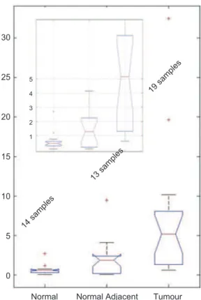 Figure 6.  Boxplot of the real-time polymerase chain reaction meas- meas-urements for normal, adjacent-to-tumour and tumour samples