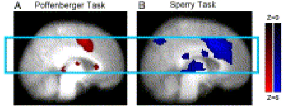 Fig. 2. Group activation for the Poffenberger task (A: left) and the Sperry task (B: right)