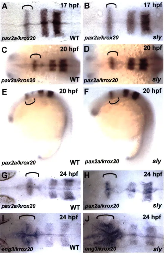 FIGURE 4 A l7hpf  B WT  pax2a/ki 20  hpf  F pax2a/krox2O  WT  pax2a/krox20 20 hpf sly 24 hpf sly.