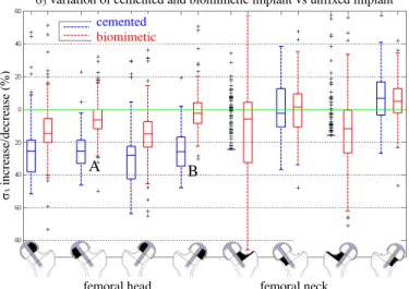 Figure 1: Increase/decrease of maximum compressive stress  when comparing cemented metallic stem and biomimetic stem  with unfixed stem